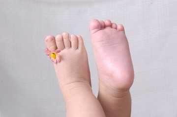千萬別用熱水給孩子泡腳